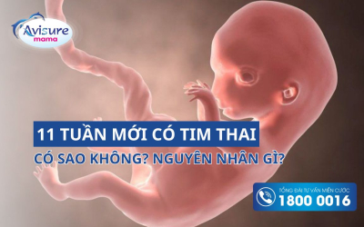 Mang bầu 11 tuần mới có tim thai có sao không? Nguyên nhân là gì?